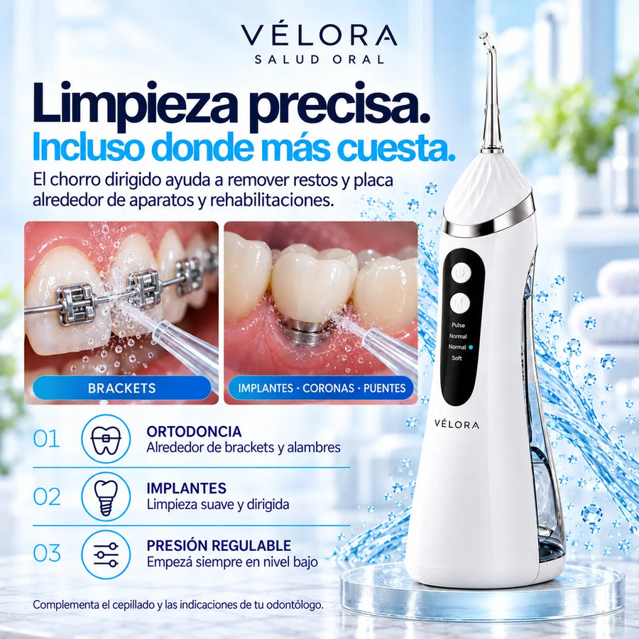 Limpieza de brackets, implantes, coronas y puentes