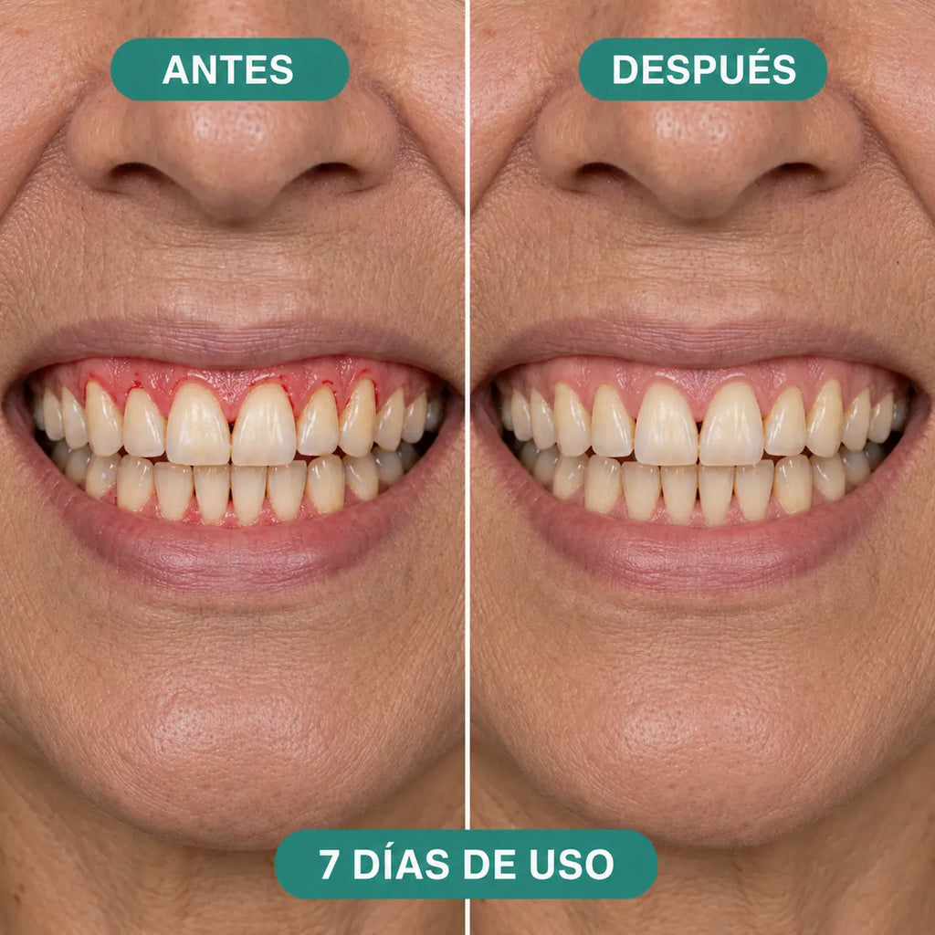 Antes y después de 7 días de uso del irrigador Velora - mujer mayor